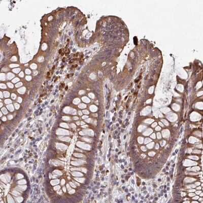 Immunohistochemistry-Paraffin: TRIM14 Antibody [NBP2-47596] - Staining of human colon shows moderate cytoplasmic positivity in lymphoid cells.
