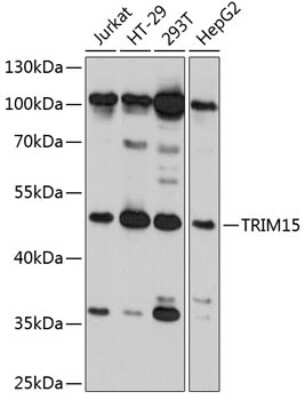 Western Blot: TRIM15 Antibody [NBP2-93710] - Analysis of extracts of various cell lines, using TRIM15 at 1:3000 dilution. Secondary antibody: HRP Goat Anti-Rabbit IgG (H+L) at 1:10000 dilution. Lysates/proteins: 25ug per lane. Blocking buffer: 3% nonfat dry milk in TBST. Detection: ECL Basic Kit . Exposure time: 10s.