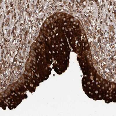 Immunohistochemistry-Paraffin: TRIM16 Antibody [NBP1-84921] - Staining of human urinary bladder shows strong cytoplasmic positivity in urothelial cells.