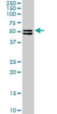 Western Blot: TRIM16 Antibody [H00010626-D01P] - Analysis of TRIM16 expression in HeLa.