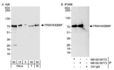 Western Blot: TRIM16 Antibody [NB100-59772] - Detection of Human and Mouse TRIM16/EBBP on HeLa whole cell lysate (5, 15, 50 microgram for WB, 1 mg for IP, 20% of IP loaded), 293T (T; 50 microgram), and mouse NIH3T3 (M; 50 microgram) using NB100-59772. TRIM16/EBBP was also immunoprecipitated by rabbit anti-TRIM16/EBBP antibody NB100-59773.