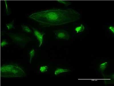 Immunocytochemistry/Immunofluorescence: TRIM17 Antibody (2D3) [H00051127-M03] - Analysis of monoclonal antibody to TRIM17 on HeLa cell. Antibody concentration 10 ug/ml