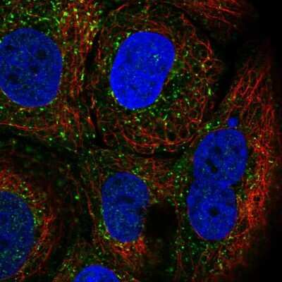 Immunocytochemistry/ Immunofluorescence TRIM17 Antibody