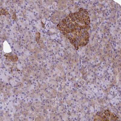 Immunohistochemistry: TRIM17 Antibody [NBP2-49156] - Staining of human pancreas shows strong cytoplasmic positivity in islets of Langerhans.