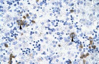 Immunohistochemistry-Paraffin: TRIM17 Antibody [NBP1-80043] - Human Liver Tissue, antibody concentration 4-8ug/ml. Cells with positive label: Hepatocytes (indicated with arrows) 400X magnification.