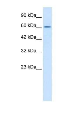 Western Blot: TRIM17 Antibody [NBP1-80043] - Jurkat cell lysate, Antibody Titration: 0.12ug/ml