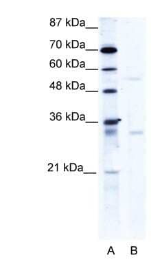 Western Blot: TRIM17 Antibody [NBP1-80044] - HepG2 cell lysate, concentration 1.25ug/ml.