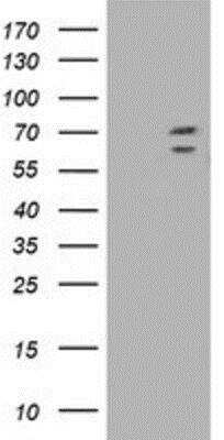 Western Blot: TRIM2 Antibody (2B10) [NBP2-02928] - HEK293T cells were transfected with the pCMV6-ENTRY control (Left lane) or pCMV6-ENTRY TRIM2 (Right lane) cDNA for 48 hrs and lysed. Equivalent amounts of cell lysates (5 ug per lane) were separated by SDS-PAGE and immunoblotted with anti-TRIM2.