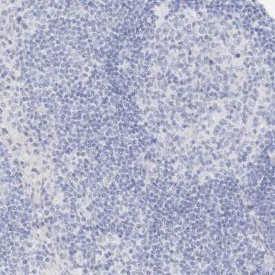 Immunohistochemistry-Paraffin: TRIM2 Antibody [NBP1-81504] - Staining of human lymph node shows low expression as expected.