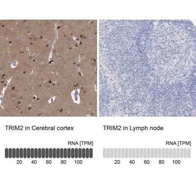 <b>Orthogonal Strategies Validation. </b>Immunohistochemistry-Paraffin: TRIM2 Antibody [NBP1-81504] - Staining in human cerebral cortex and lymph node tissues using anti-TRIM2 antibody. Corresponding TRIM2 RNA-seq data are presented for the same tissues.