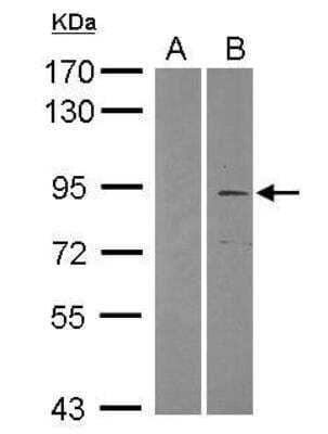 Western Blot: TRIM2 Antibody [NBP2-20709] - Analysis of TRIM2 expression in transfected 293T cell line (20ug of whole cell ltsate) A: Non-transfected lysate. B: TRIM2 transfected lysate. 7.5% SDS PAGE diluted at 1:1000