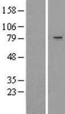 Western Blot: TRIM2 Overexpression Lysate (Adult Normal) [NBL1-17280] Left-Empty vector transfected control cell lysate (HEK293 cell lysate); Right -Over-expression Lysate for TRIM2.