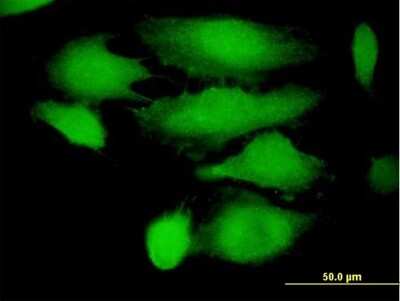 Immunocytochemistry/Immunofluorescence: TRIM21/SSA1 Antibody [H00006737-B01P] - Analysis of purified antibody to TRIM21 on HeLa cell. (antibody concentration 10 ug/ml)
