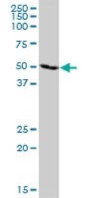 Western Blot: TRIM21/SSA1 Antibody [H00006737-B01P] - Analysis of TRIM21 expression in A-431.