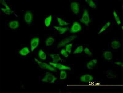 Immunocytochemistry/Immunofluorescence: TRIM25 Antibody [H00007706-B01P] - Analysis of purified antibody to TRIM25 on HeLa cell. (antibody concentration 10 ug/ml)