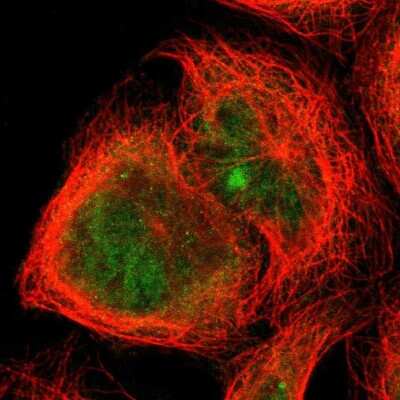 Immunocytochemistry/Immunofluorescence: TRIM25 Antibody [NBP1-84891] - Staining of human cell line A-431 shows localization to nucleoplasm, nuclear bodies & cytosol. Antibody staining is shown in green.