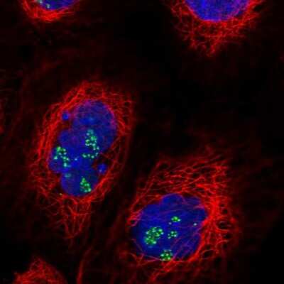 Immunocytochemistry/Immunofluorescence: TRIM27 Antibody [NBP2-54993] - Staining of human cell line A-431 shows localization to nucleoli fibrillar center.