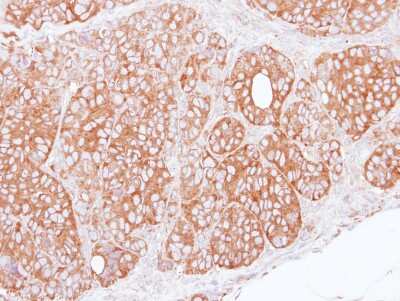 Immunohistochemistry-Paraffin: TRIM27 Antibody [NBP1-32098] - Paraffin-embedded SW480 xenograft, using antibody at 1:100 dilution.