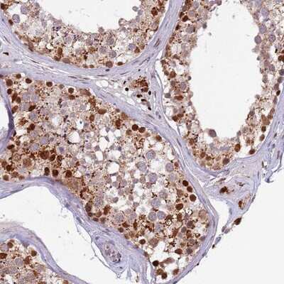 Immunohistochemistry-Paraffin: TRIM27 Antibody [NBP2-13482] - Staining of human testis shows strong nuclear positivity in cells of seminiferus ducts.