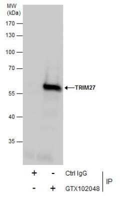 Immunoprecipitation: TRIM27 Antibody [NBP2-20711] - Immunoprecipitation of TRIM27 protein from Jurkat whole cell extracts using 5 ug of TRIM27 antibody. Western blot analysis was performed using TRIM27 antibody.