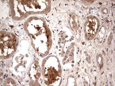 Immunohistochemistry: TRIM27 Antibody (OTI4D4) - Azide and BSA Free [NBP2-74609] - Analysis of Human Kidney tissue. (Heat-induced epitope retrieval by 1 mM EDTA in 10mM Tris, pH8.5, 120C for 3min)