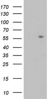 Western Blot: TRIM27 Antibody (OTI4D4) - Azide and BSA Free [NBP2-74609] - Analysis of HEK293T cells were transfected with the pCMV6-ENTRY control (Left lane) or pCMV6-ENTRY TRIM27.