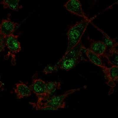 Immunocytochemistry/Immunofluorescence: TRIM27 Antibody (PCRP-TRIM27-1B3) [NBP3-07415] - Immunofluorescence Analysis of PFA-fixed U87 cells using TRIM27 Mouse Monoclonal Antibody (PCRP-TRIM27-1B3) followed by goat anti- Mouse IgG-CF488 (green). CF640A phalloidin (red).