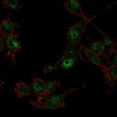 Immunocytochemistry/Immunofluorescence: TRIM27 Antibody (PCRP-TRIM27-1B3) [NBP3-08579] - Immunofluorescence Analysis of PFA-fixed U87 cells using TRIM27 Mouse Monoclonal Antibody (PCRP-TRIM27-1B3) followed by goat anti- Mouse IgG-CF488 (green). CF640A phalloidin (red).