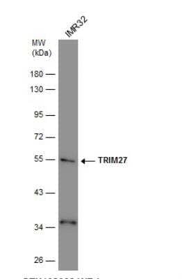 Western Blot: TRIM27 Antibody [NBP1-32098] - Whole cell extract (30 ug) was separated by 10% SDS-PAGE, and the membrane was blotted with TRIM27 antibody diluted at 1:1000.