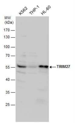 Western Blot: TRIM27 Antibody [NBP2-20711] - TRIM27 antibody detects TRIM27 protein by western blot analysis. Various whole cell extracts (30 ug) were separated by 10% SDS-PAGE, and the membrane was blotted with TRIM27 antibody diluted by 1:500.