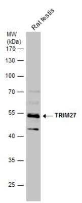 Western Blot: TRIM27 Antibody [NBP2-20711] - Rat tissue extract (50 ug) was separated by 10% SDS-PAGE, and the membrane was blotted with TRIM27 antibody diluted at 1:500.