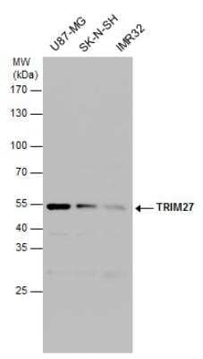 Western Blot: TRIM27 Antibody [NBP2-20711] - TRIM27 antibody detects TRIM27 protein by western blot analysis. Various whole cell extracts (30 ug) were separated by 10% SDS-PAGE, and the membrane was blotted with TRIM27 antibody diluted at a dilution of 1:500.