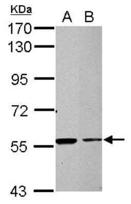 Western Blot: TRIM27 Antibody [NBP2-20712] - Sample (30 ug of whole cell lysate)  A: NT2D1  B: SK-N-SH  7.5% SDS PAGE diluted at 1:1000 