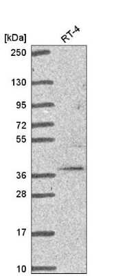 Western Blot: TRIM27 Antibody [NBP2-54993] - Western blot analysis in human cell line RT-4.