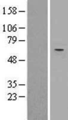 Western Blot: TRIM27 Overexpression Lysate (Adult Normal) [NBL1-17287] Left-Empty vector transfected control cell lysate (HEK293 cell lysate); Right -Over-expression Lysate for TRIM27.