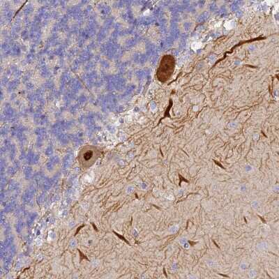 Immunohistochemistry: TRIM3/BERP Antibody [NBP2-48791] - Staining of human cerebellum shows strong nuclear and cytoplasmic positivity in Purkinje cells.