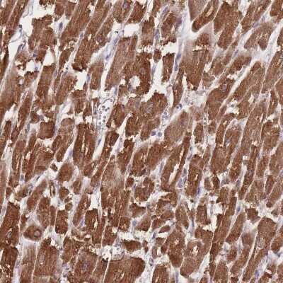 Immunohistochemistry: TRIM3/BERP Antibody [NBP2-48897] - Staining of human heart muscle shows strong cytoplasmic positivity in myocytes.