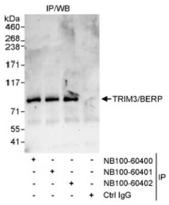 <b>Independent Antibodies Validation. </b>Immunoprecipitation: TRIM3/BERP Antibody [NB100-60400] - Whole cell lysate (1 mg for IP, 20% of IP loaded) from HeLa cells. NB100-60400 used for IP at 3 mcg/mg lysate. TRIM3/BERP was also immunoprecipitated by rabbit anti-TRIM3/BERP antibodies NB100-60401 and NB100-60402, which recognize downstream epitopes.