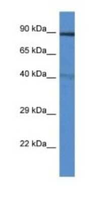 Western Blot: TRIM3/BERP Antibody [NBP1-79699] - Titration: 1.0 ug/ml Positive Control: Mouse Heart.