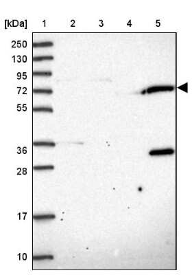 Western Blot: TRIM3/BERP Antibody [NBP2-48791] - Lane 1: Marker [kDa] 250, 130, 95, 72, 55, 36, 28, 17, 10Lane 2: Human cell line RT-4Lane 3: Human cell line U-251MG spLane 4: Human plasma (IgG/HSA depleted)Lane 5: Human liver tissue