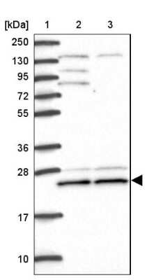 Western Blot: TRIM3/BERP Antibody [NBP2-48897] - Lane 1: Marker [kDa] 250, 130, 95, 72, 55, 36, 28, 17, 10Lane 2: Human cell line RT-4Lane 3: Human cell line U-251MG sp