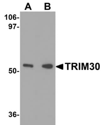 Western Blot: TRIM30 Antibody [NBP2-41087] - Analysis of TRIM30 in mouse heart tissue lysate with TRIM30 antibody at (A) 1 and (B) 2 ug/mL.