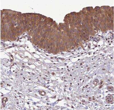 Immunohistochemistry-Paraffin: TRIM31 Antibody [NBP2-13483] - Staining of human urinary bladder shows strong cytoplasmic positivity in urothelial cells.