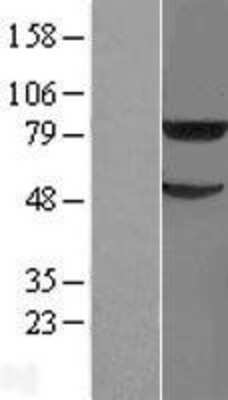 Western Blot TRIM31 Overexpression Lysate