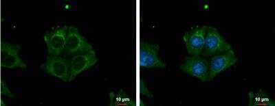 Immunocytochemistry/Immunofluorescence: TRIM32 Antibody [NBP1-33737] - A375 cells were fixed in ice-cold MeOH for 5 min. Green: TRIM32 protein stained by TRIM32 antibody diluted at 1:500. Blue: Hoechst 33342 staining. Scale bar = 10 um.