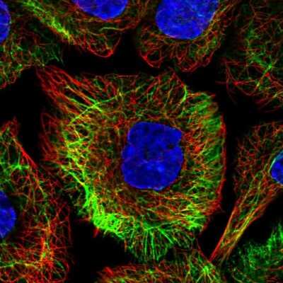 Immunocytochemistry/Immunofluorescence: TRIM32 Antibody [NBP2-13484] - Immunofluorescent staining of human cell line A-431 shows localization to intermediate filaments.