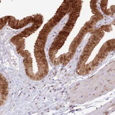 Immunohistochemistry-Paraffin: TRIM32 Antibody [NBP2-13484] - Staining of human gallbladder shows strong nuclear and cytoplasmic positivity in glandular cells.