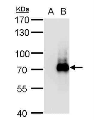 Western Blot: TRIM32 Antibody [NBP1-33737] - A. 5 ug 293T whole cell lysate/extract B. 5 ug whole cell lysate/extract of DDDDK-human TRIM32-transfected 293T cells 7.5 % SDS-PAGE TRIM32 antibody  dilution: 1:20000