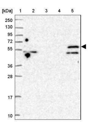 Western Blot: TRIM32 Antibody [NBP2-13484] - Lane 1: Marker  [kDa] 250, 130, 95, 72, 55, 36, 28, 17, 10.  Lane 2: Human cell line RT-4.  Lane 3: Human cell line U-251MG sp.  Lane 4: Human plasma (IgG/HSA depleted).  Lane 5: Human liver tissue