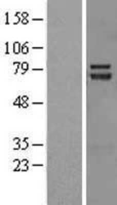 Western Blot: TRIM32 Overexpression Lysate (Adult Normal) [NBL1-17292] Left-Empty vector transfected control cell lysate (HEK293 cell lysate); Right -Over-expression Lysate for TRIM32.